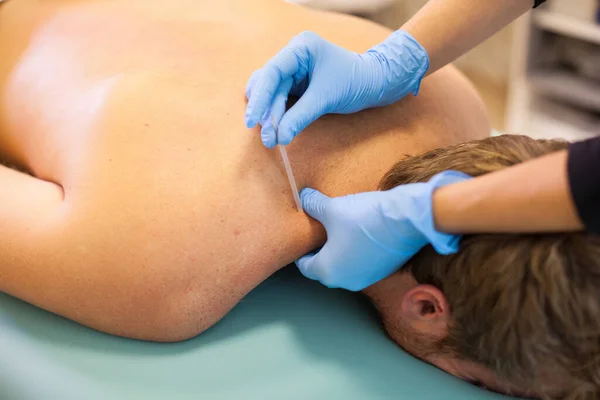 DryNeedling in nek